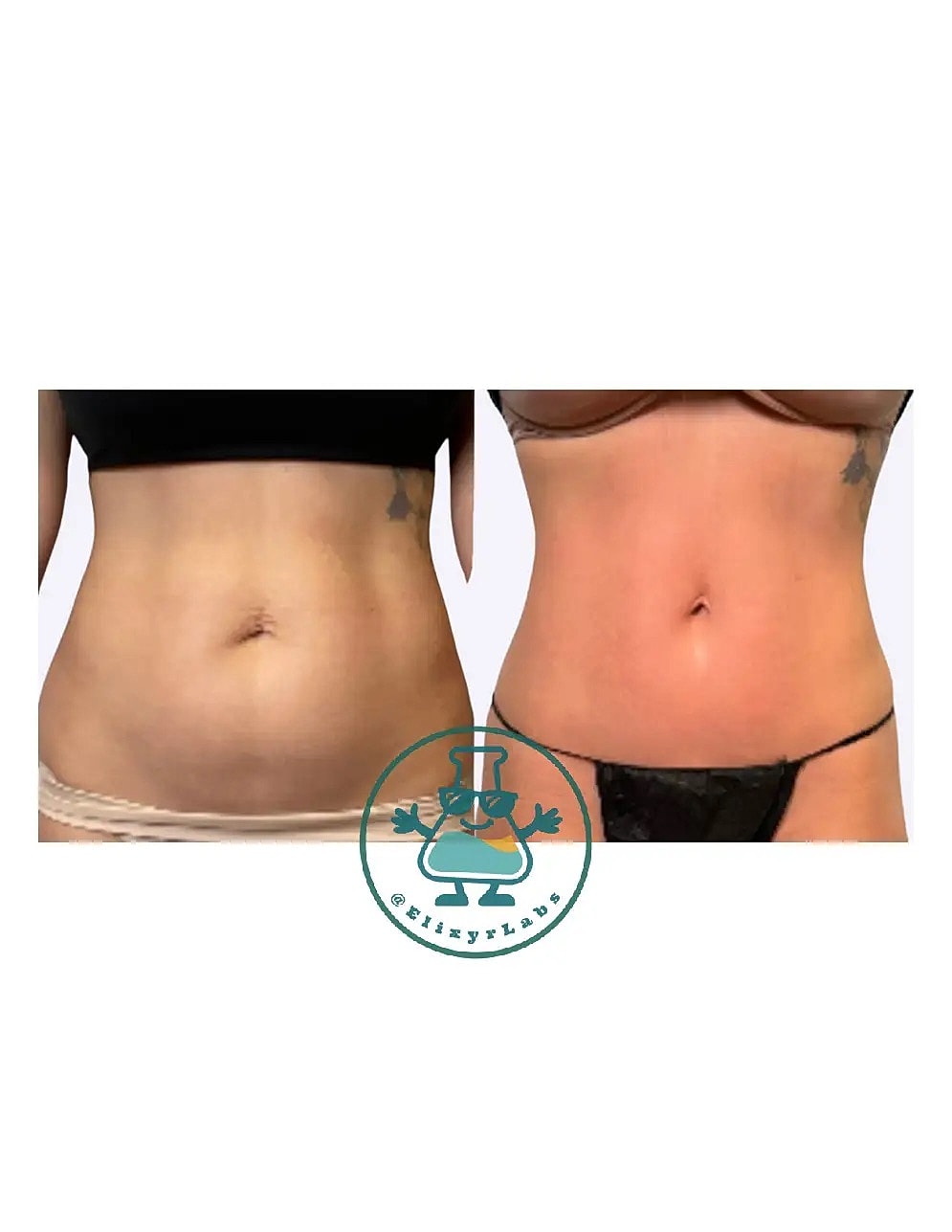 T Shape Before & After