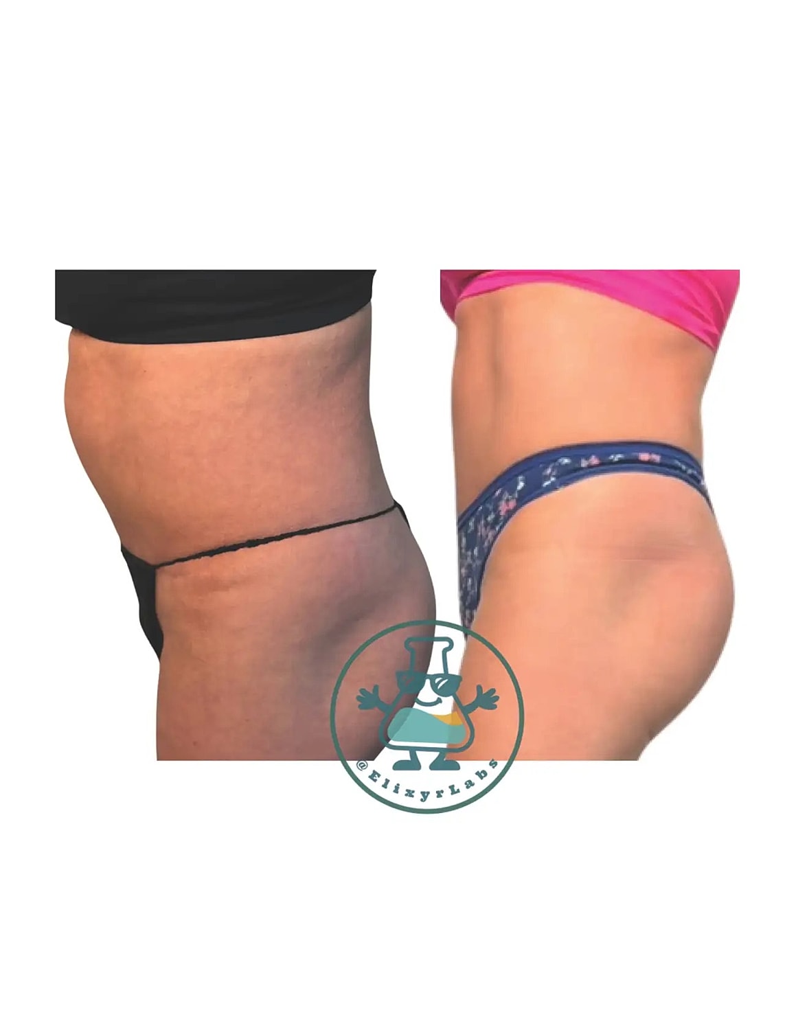 T Shape Before & After