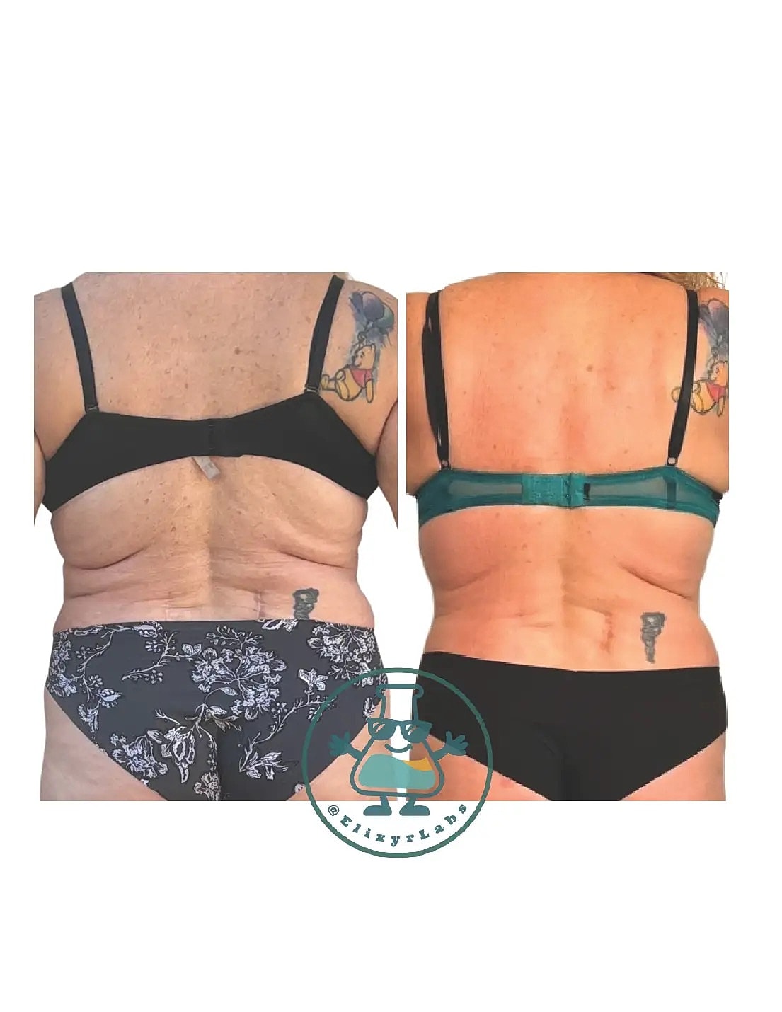 T Shape Before & After