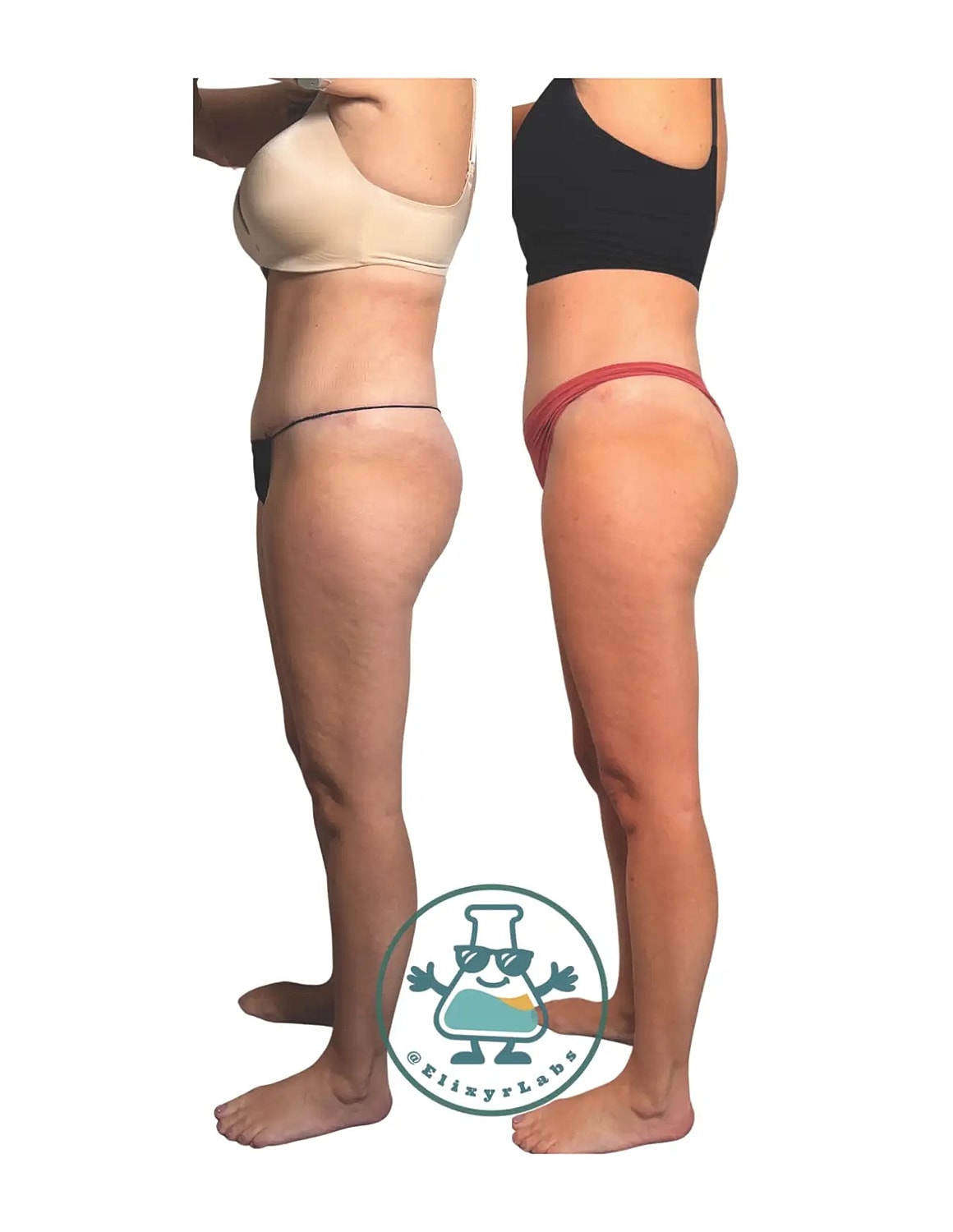 T Shape Before & After