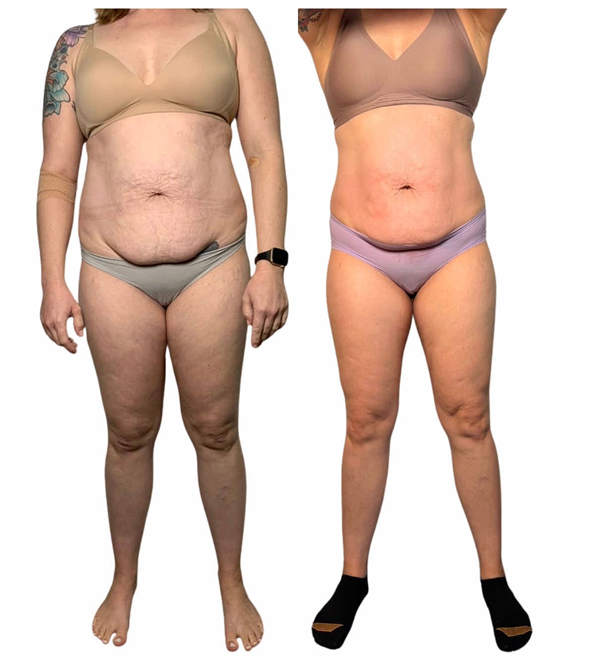Before and after transformation photo comparison.