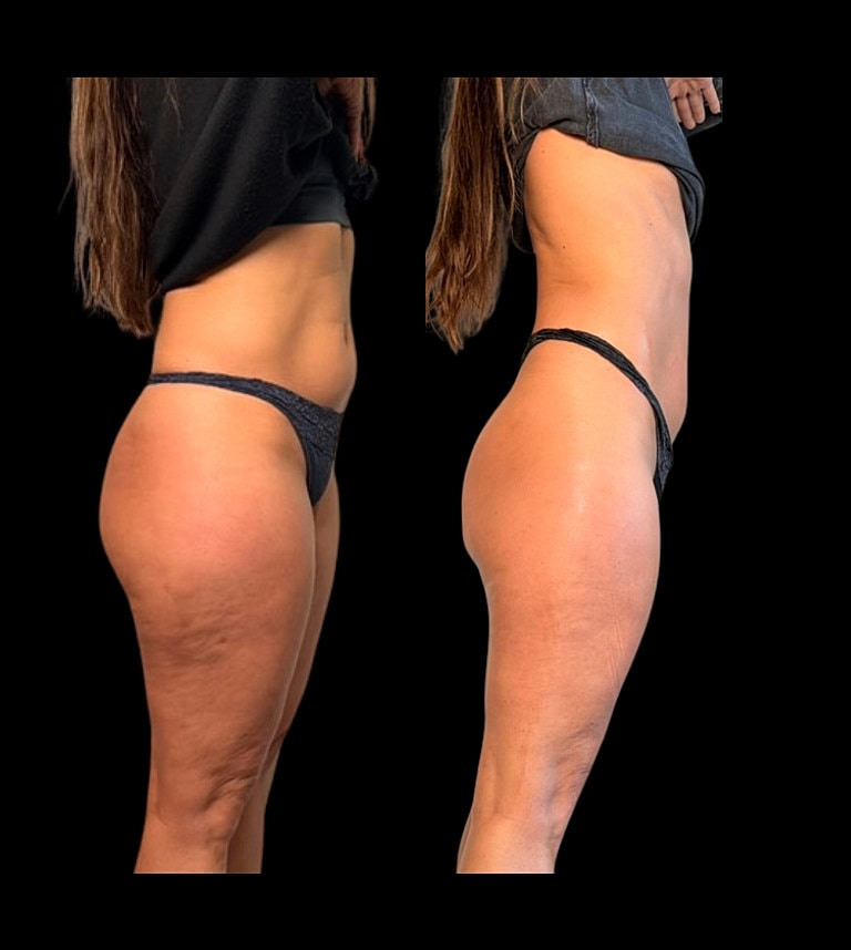 Comparison of body shape before and after.