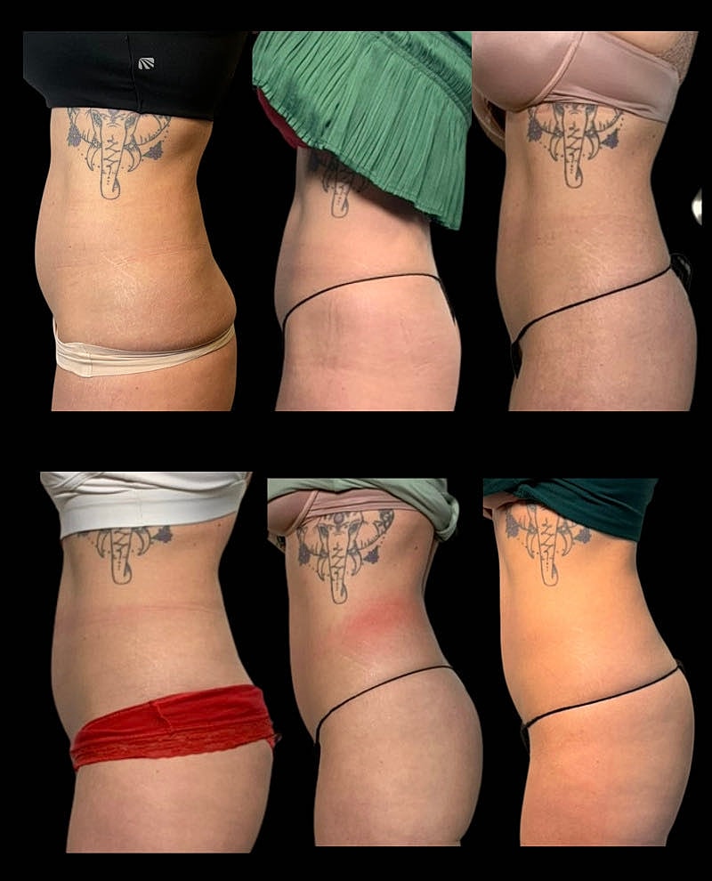 Before and after body transformation images.